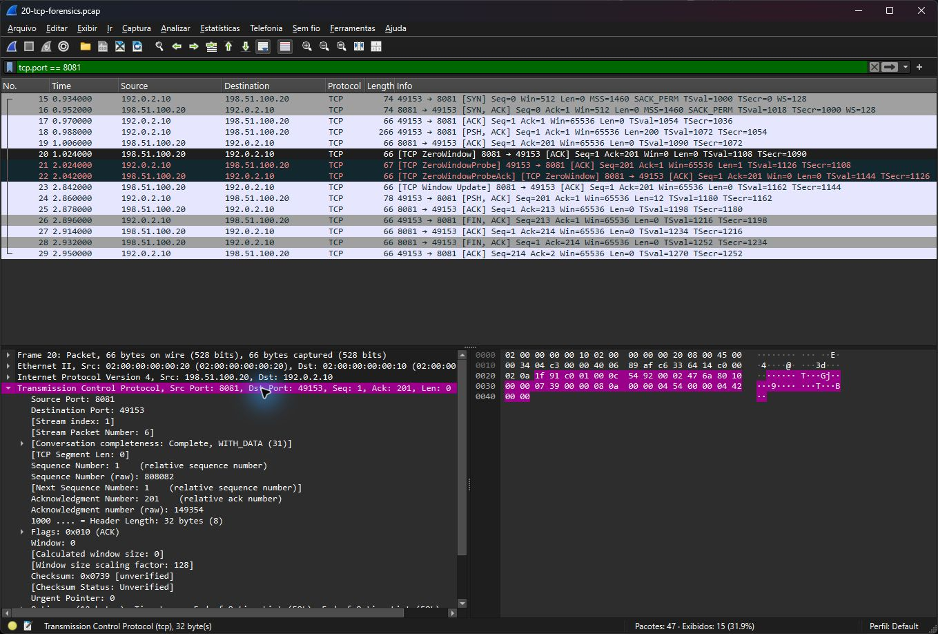 Wireshark real detalhando a conversa TCP com Zero Window, probe e Window Update
